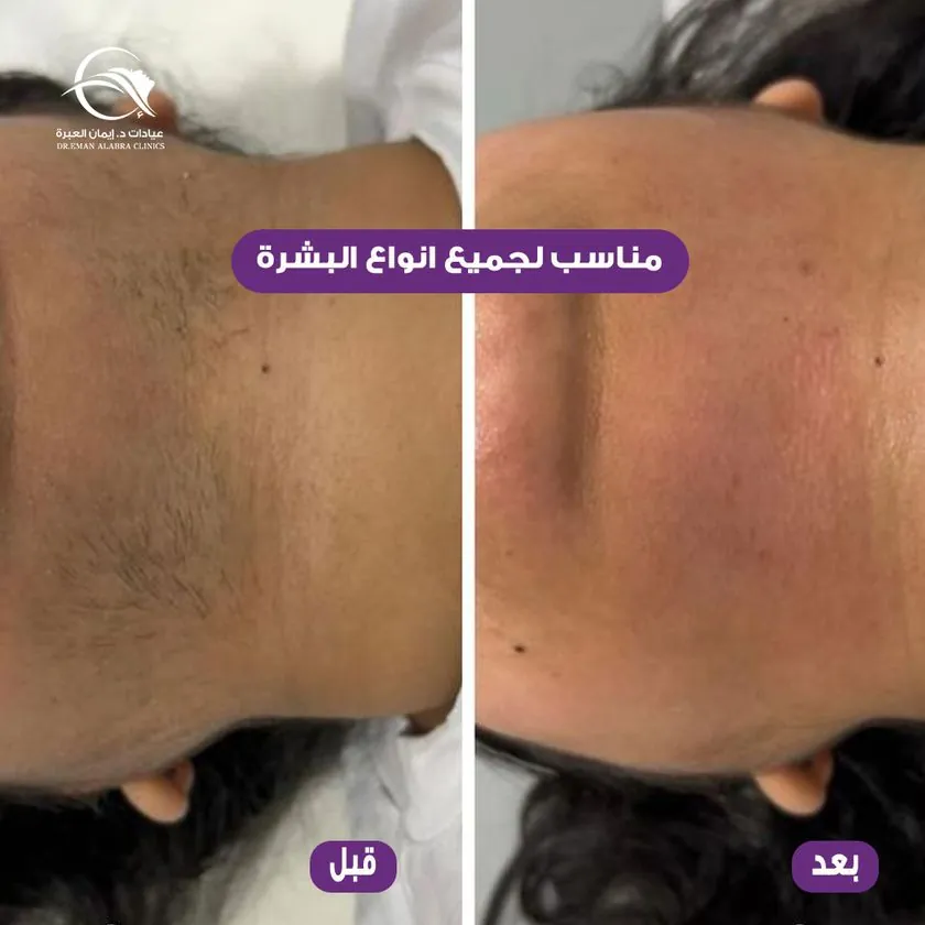 مناسب لجميع أنواع البشرة
