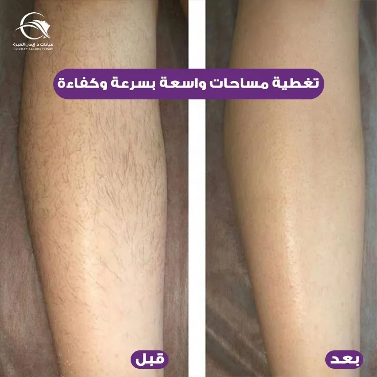 تغطية مساحات واسعة بسرعة وكفاءة